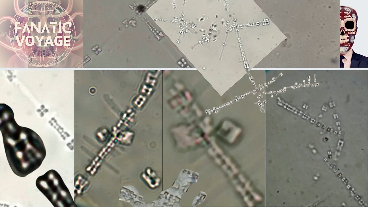 XYLONOR ANESTHETICS - MICROSTRUCTURES BECOMING MORE COMPLEX - LQC