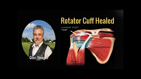 Diseased Rotator cuff Instantly Healed by the Glory of God