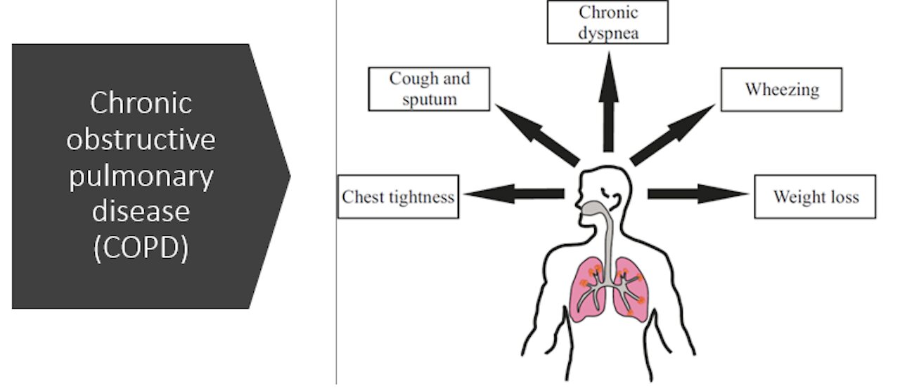 COPD (Chronic Obstructive Pulmonary Disease) - Natural Treatment