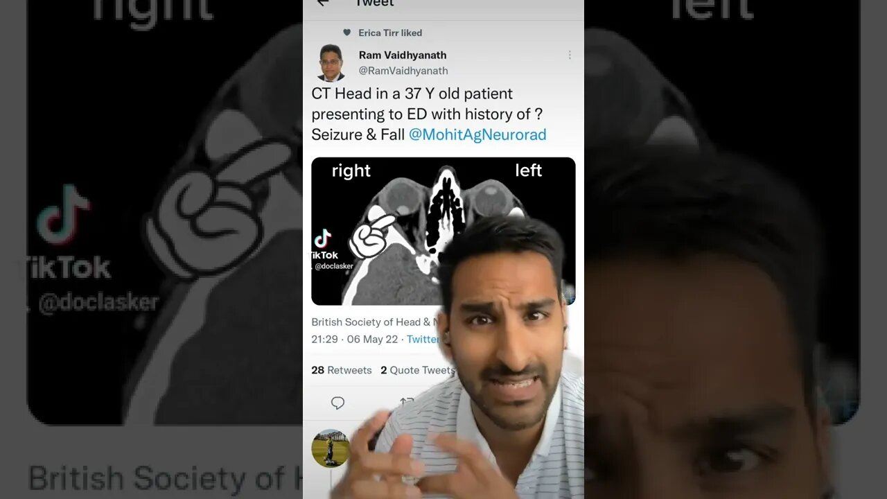 keep looking...#radiology