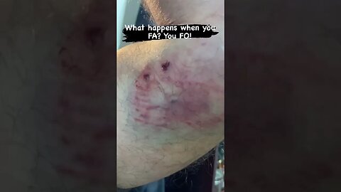 Work with bees, get stung. Work with horses, get kicked. Work with dogs, get bit.