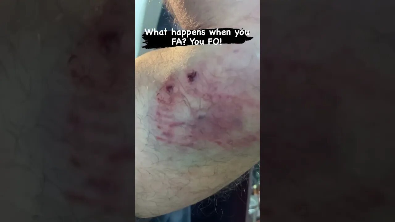 Work with bees, get stung. Work with horses, get kicked. Work with dogs, get bit.