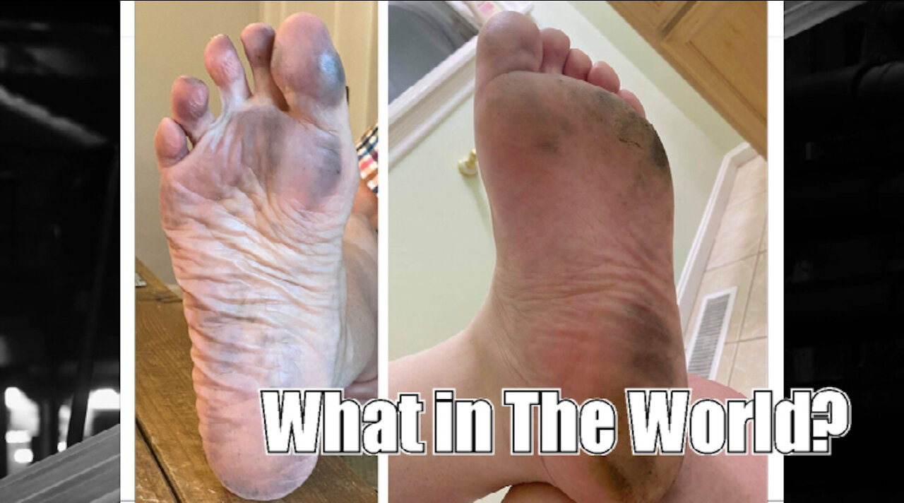 Something Weird on the Beach Was Staining Their Feet News Of The Bizarre