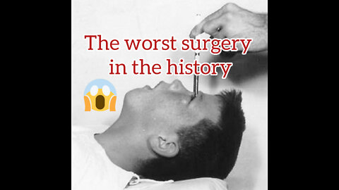 The worst surgery ever done in history