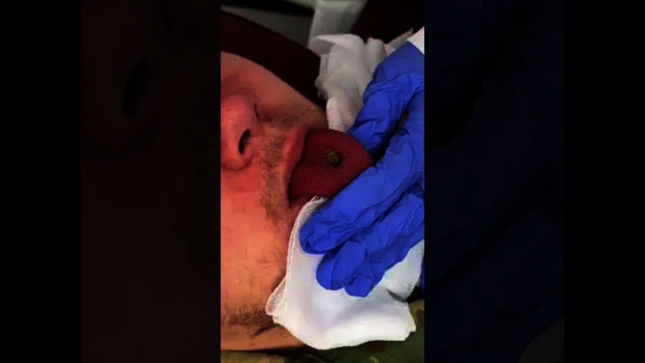 This came out of his tongue