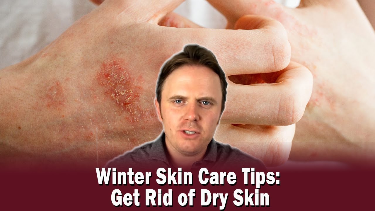 Winter Skin Care Tips: Get Rid of Dry Skin | Podcast #320