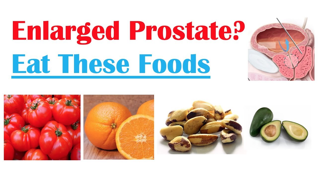 Best Foods to Eat with Reduce Risk of Enlarged Prostate Symptoms-Enlargement & Cancer