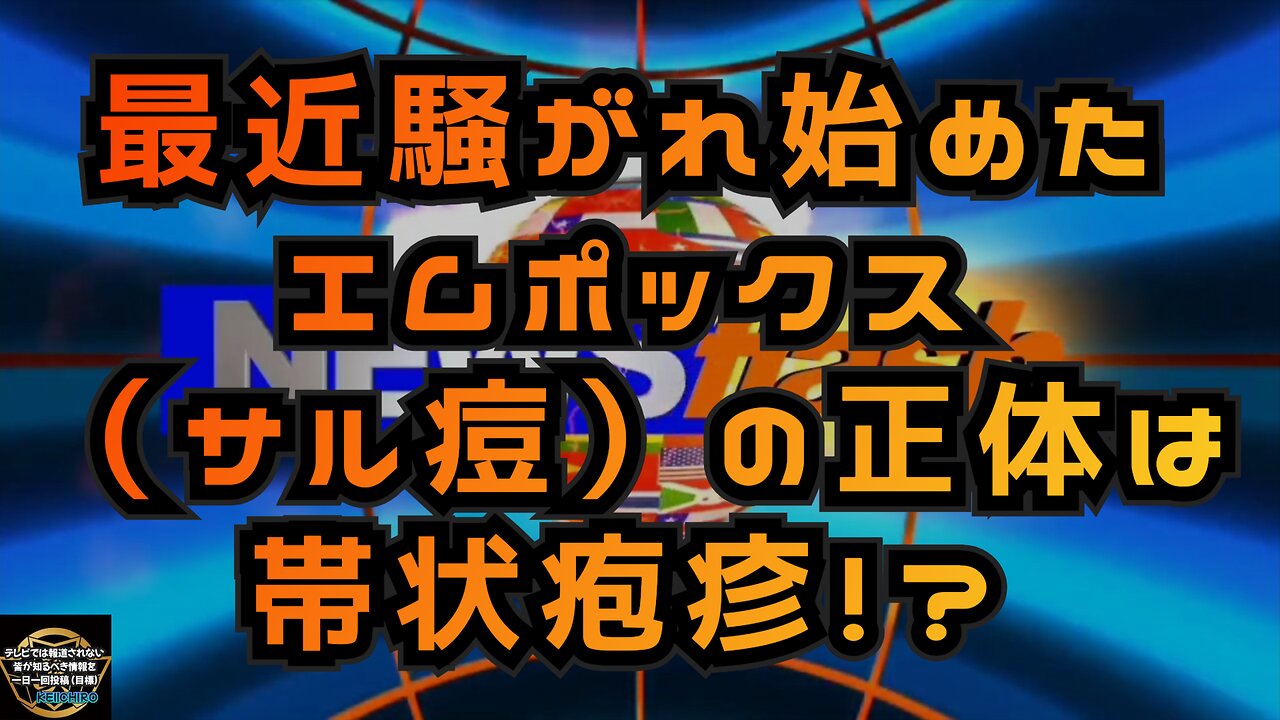 気になったニュース◆最近騒がれ始めたエムポックス（サル痘）の正体は帯状疱疹！？◆ブラックスーツが再びニコニコを攻撃するとかしないとか