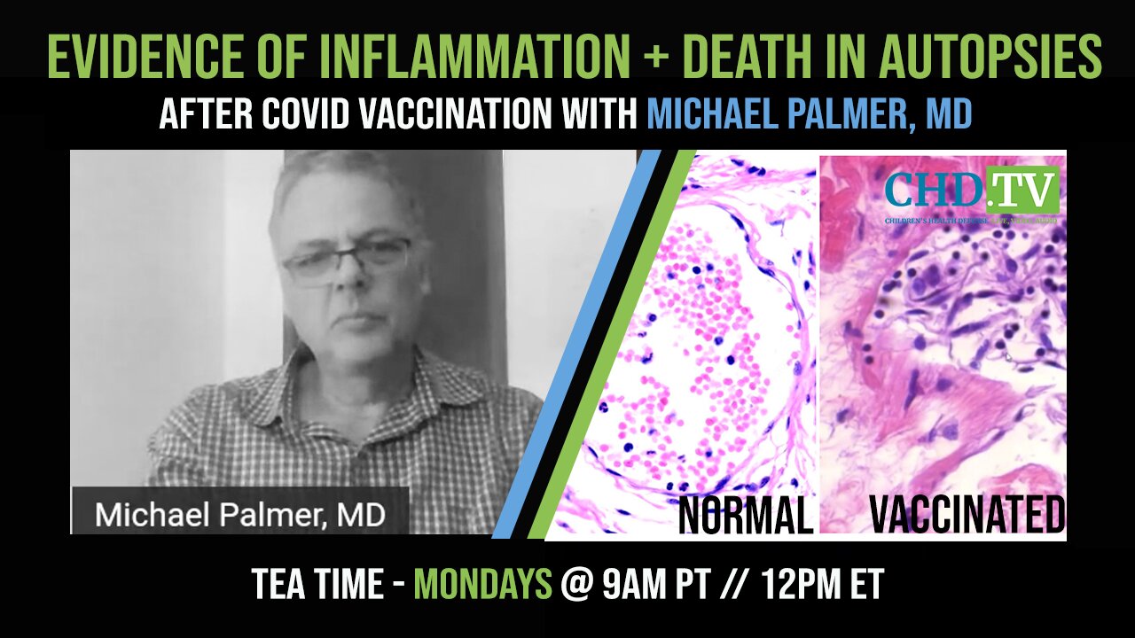 Covid Vaccines: Evidence of Persistent Inflammation + Death in Autopsies — Michael Palmer, MD