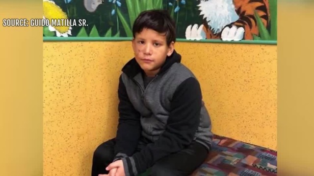 Las Vegas boy attacked by pit bulls undergoes facial surgery