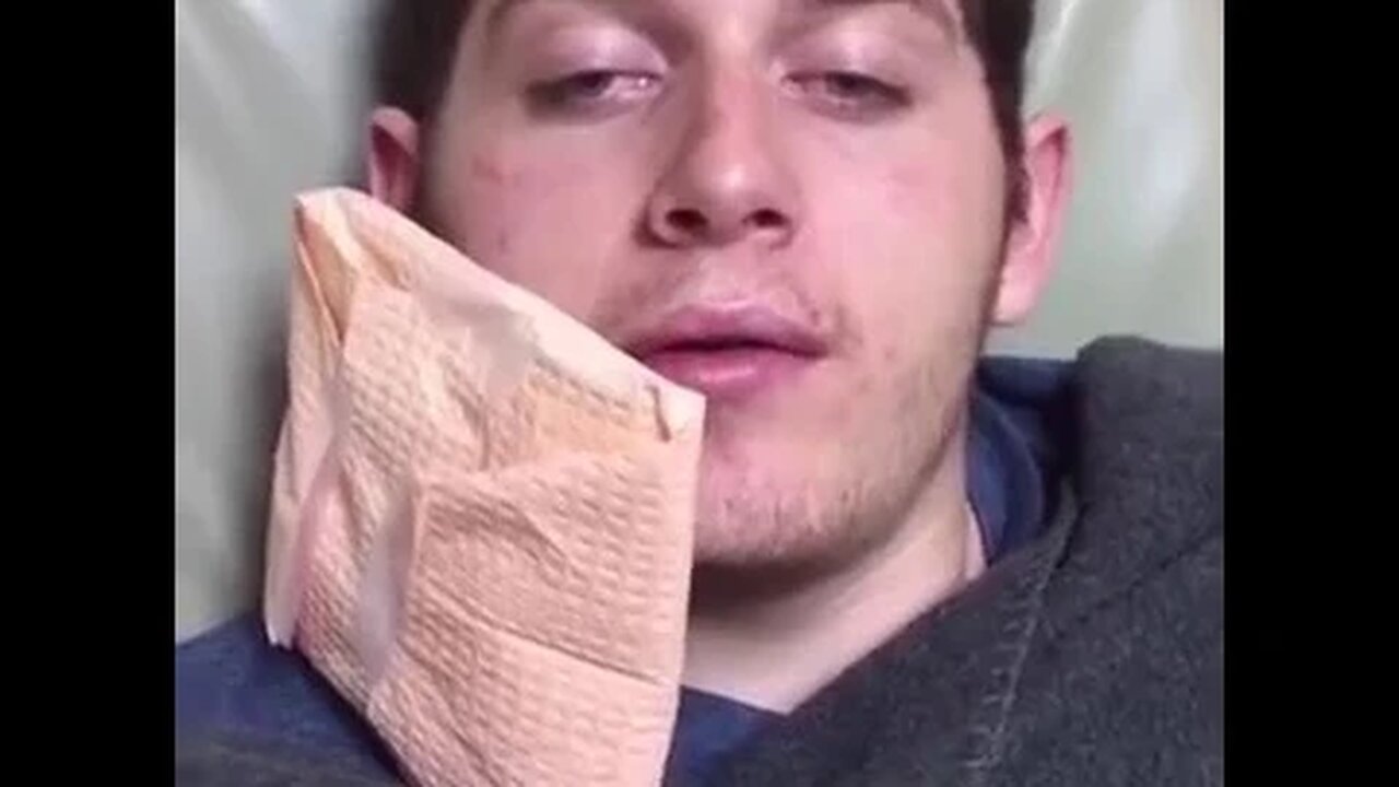 PATRICK BARNES WISDOM TEETH VIDEO!