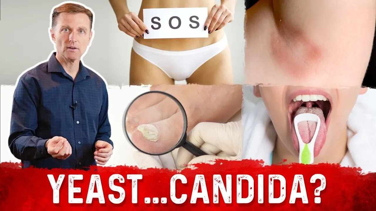 Yeast Infection vs Candida Infection: Is there a Difference? – Dr.Berg