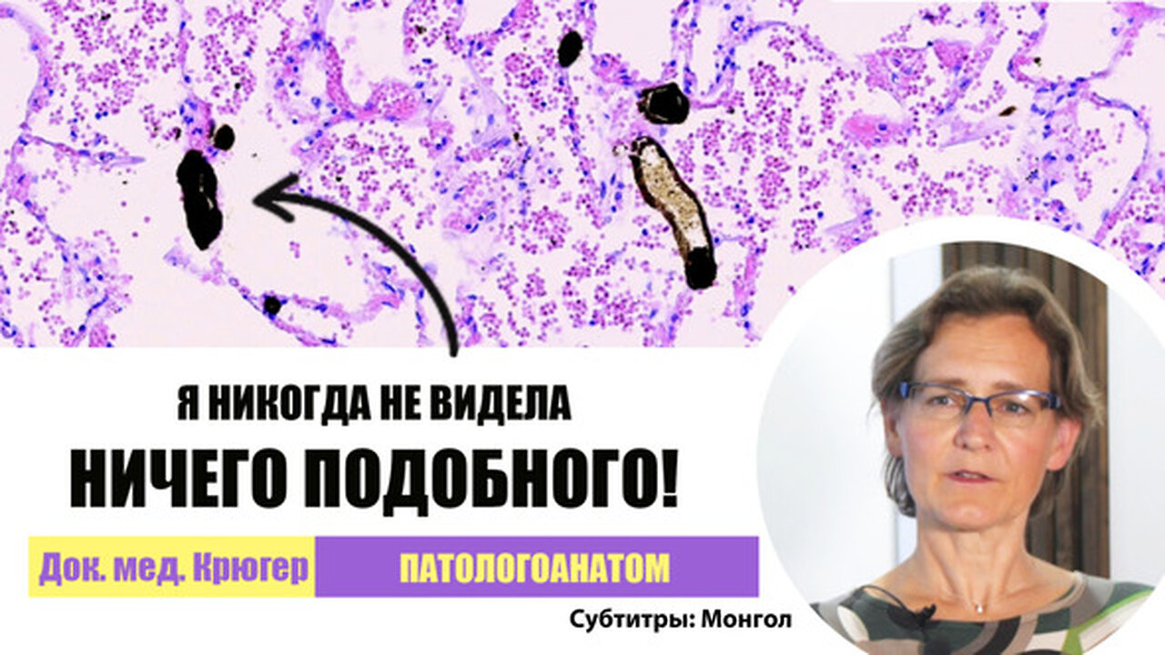 Коронавирусын эсрэг мРНХ вакцинжуулалт нь өвчин, үхлийн шалтгаан болдог! Анагаах ухааны доктор