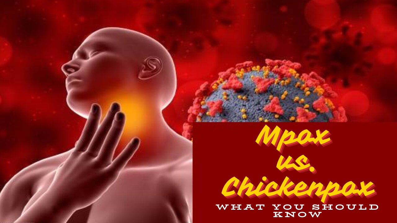 Mpox vs. Chickenpox: Key Differences Explained