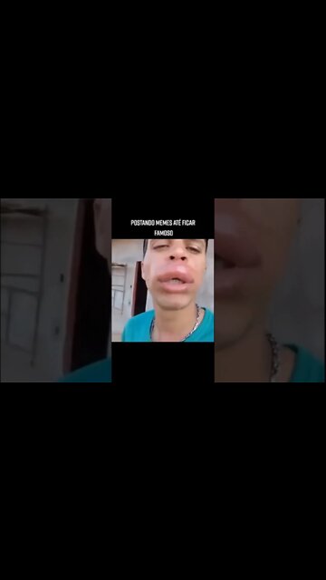 patinho feio versão humano 😂