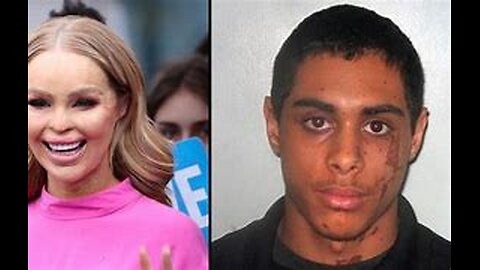 My Facebook Stalker Threw Acid In My Face | Katie Piper | Crime & True Story