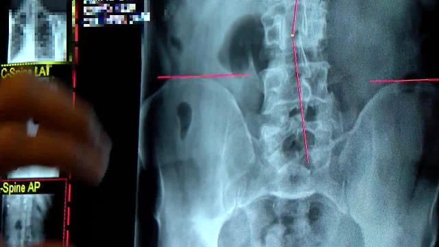 What you're ignoring that could impact weight loss