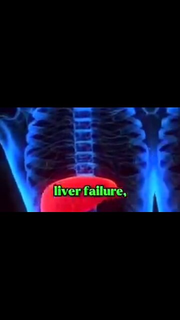 MEDICAL EXAMINER REVEALS THAT CHEMOTHERAPY AND RADIATION KILL CANCER PATIENTS ☠️