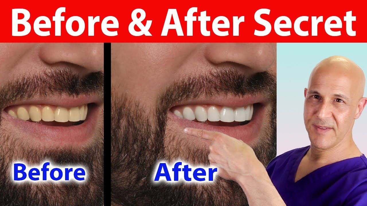 This Secret Fruit Whitens Teeth Instantly—You’ll Be Amazed