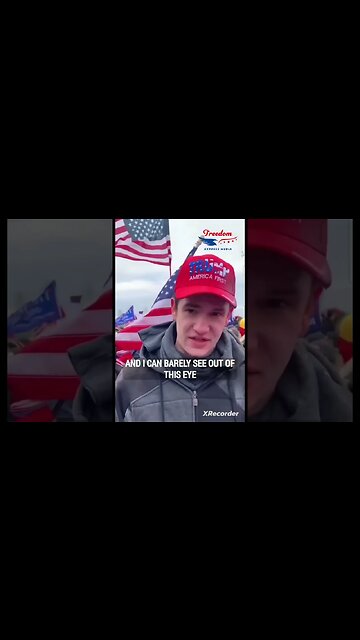 J6 Flash grenade to the face!