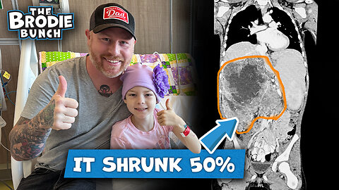 Kendall's Tumor Shrunk 50% + Neuroblastoma MIBG Scan.