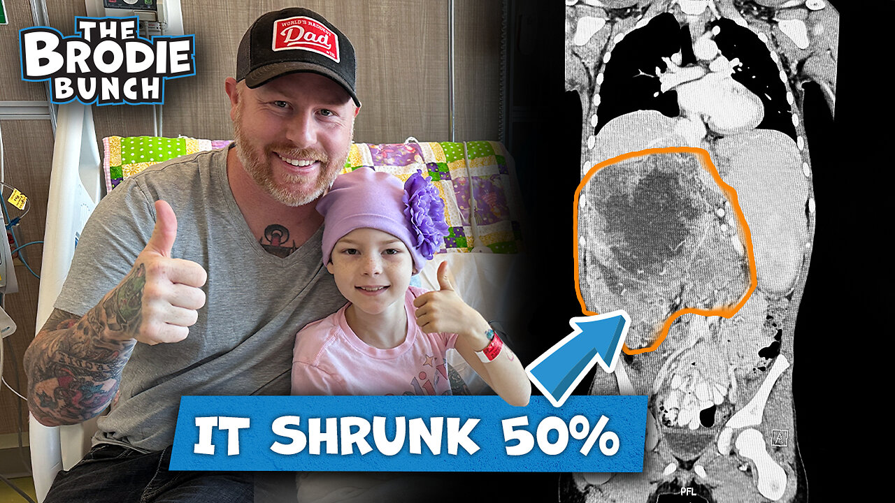 Kendall's Tumor Shrunk 50% + Neuroblastoma MIBG Scan.