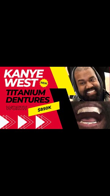 Kanye West New Titanium Dentures