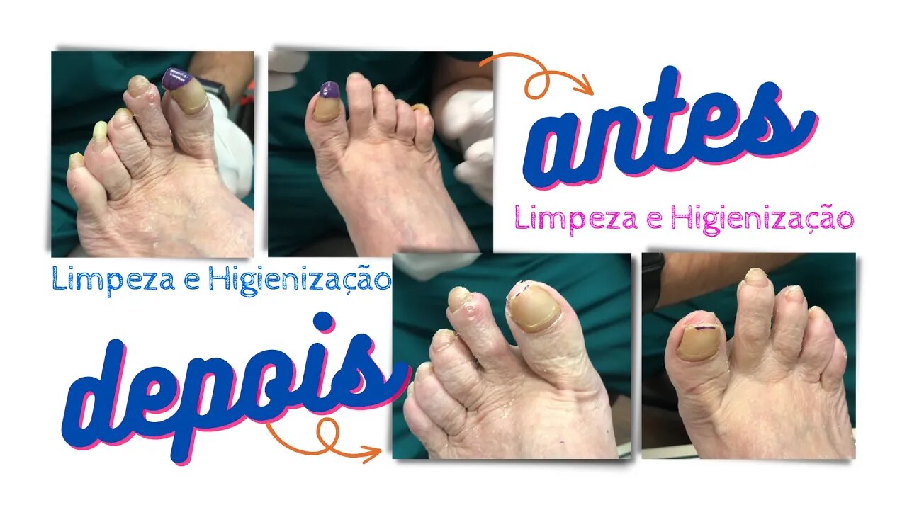 Não subestime o poder de pés saudáveis. Eles te levam para onde você quer ir! #nails #podiatrist