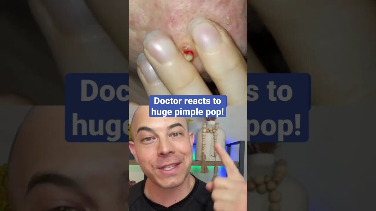 Doctor reacts to huge pimple pop!💥