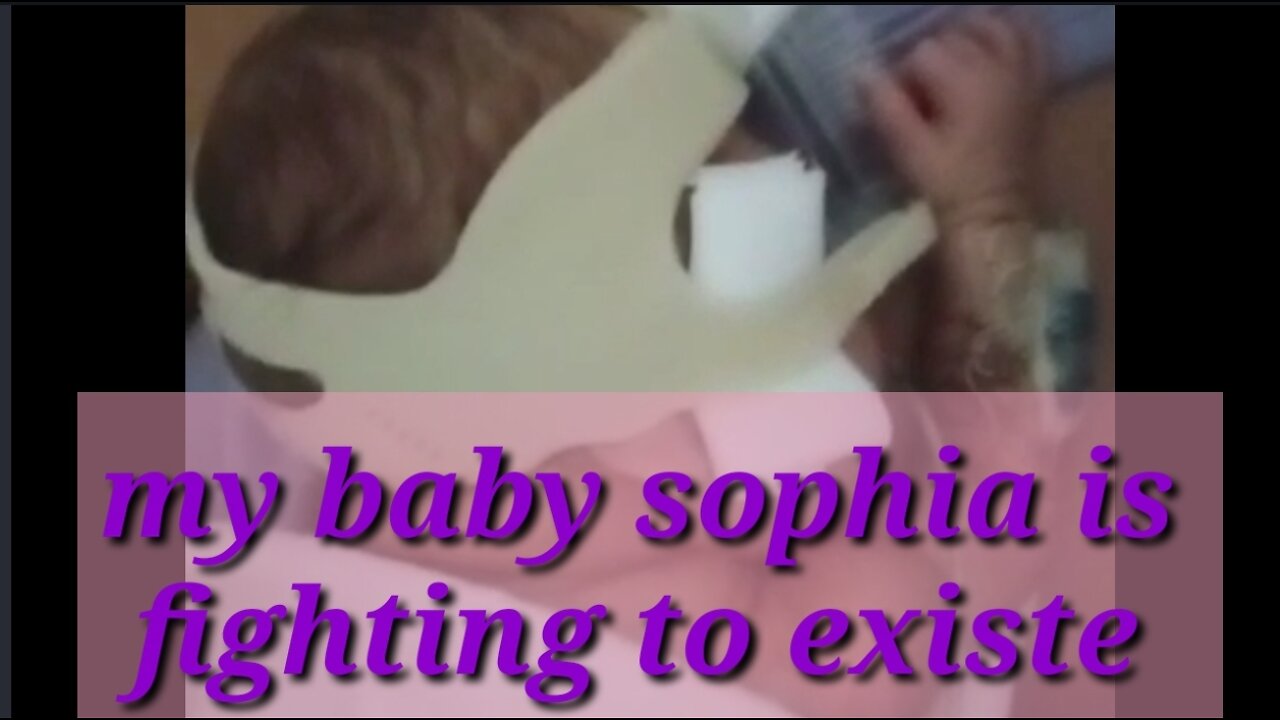 My baby sophia is fighting to exist