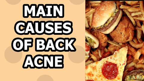 How To Get Rid Of Back Acne - 5 Causes of back acne!!