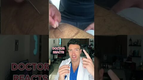 Doctor Explains "Wet-Cupping"