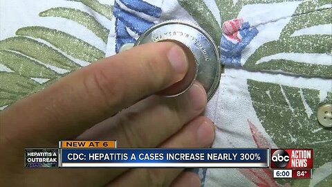 CDC says Hepatitis A cases have increased nearly 300%