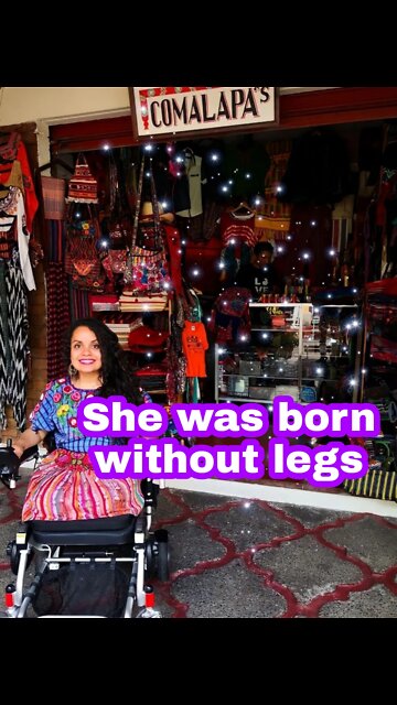 She was born without legs #dak_ampute