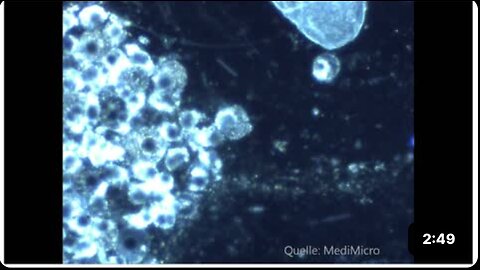 Spirochetes under the Darkfield Microscope