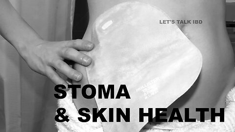 Stoma and Skin Health