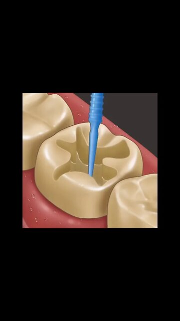 Right 👍 treatment #Shorts #ytshorts #UbertainmentFun #Dogs #Animals #Fun