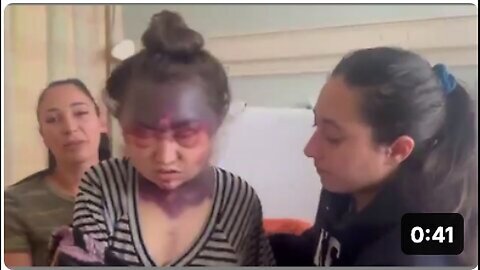 Whistleblower 23 years Old Got 3 Vaccines After Getting the Jabs in Serious Condition