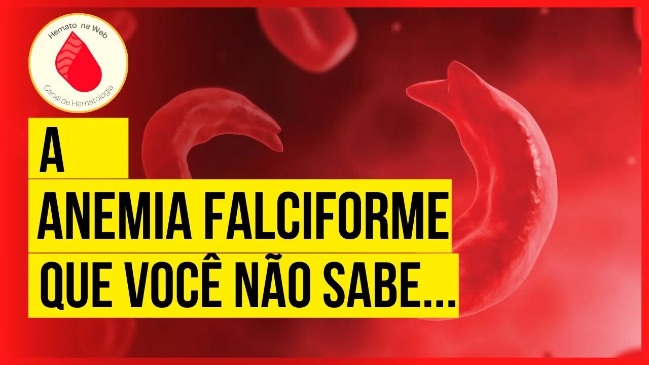 A ANEMIA FALCIFORME e suas COMPLICAÇÕES! Saiba mais! | Geydson Cruz; MD,MSc