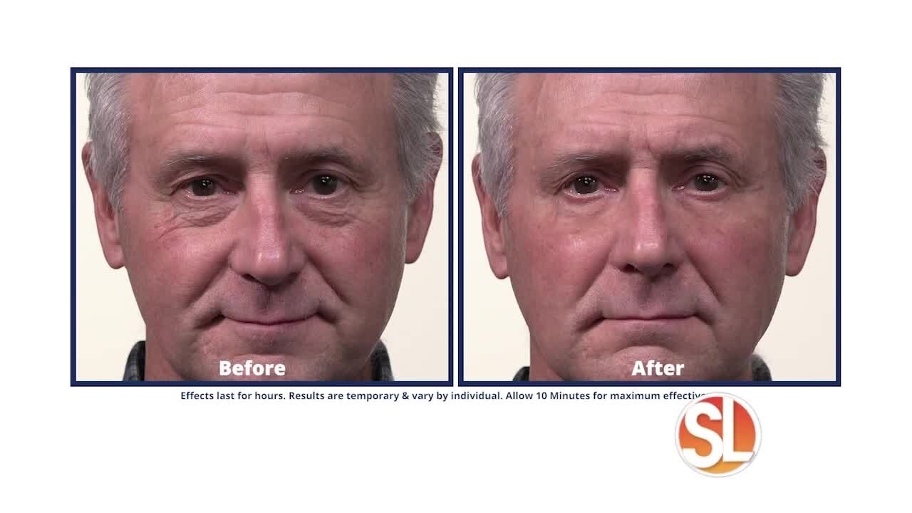 See how you can look younger with Plexaderm