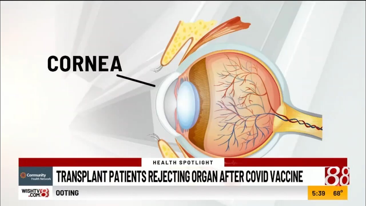 Organ Recipients Rejecting Transplant After Vaccine