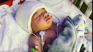 Pit bulls attack baby in Randallstown home