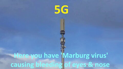 5G-caused bleeding of eyes & nose will be blamed on Marburg virus