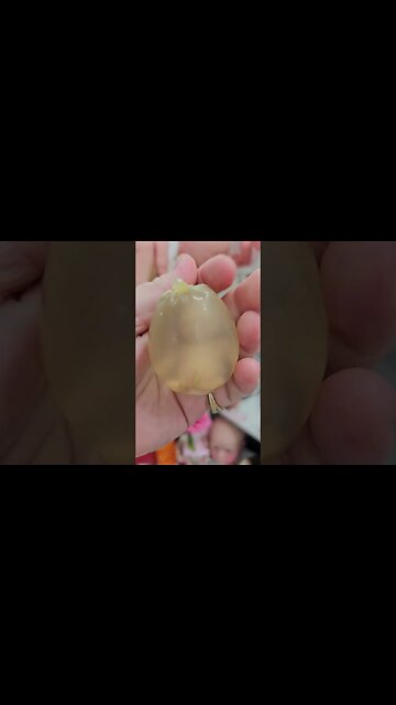 Womb Bag - World's Smallest Baby