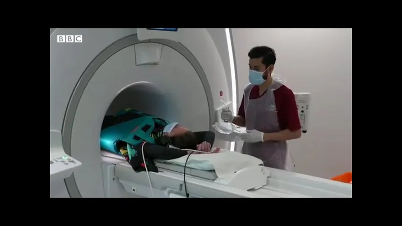 Some long Covid patients may have hidden damage to their lungs