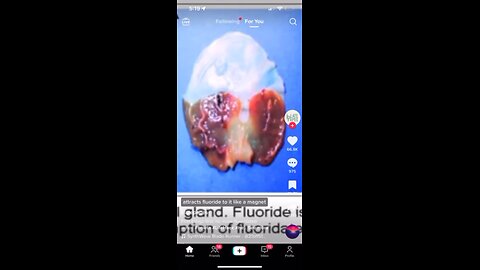 Beware fluoride