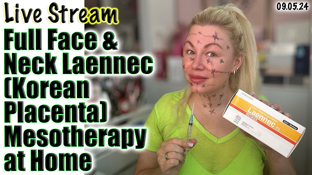 Live Full Face & Neck Laennec (Korean Placenta) Meso! AceCosm.com, code Jessica10 saves you money