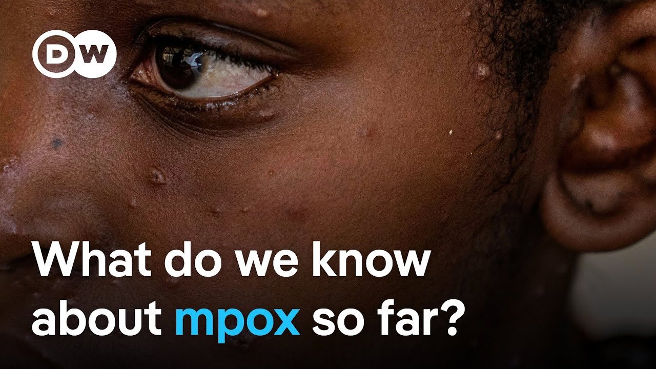 EU says further mpox cases are likely to be found soon in Europe | DW Analysis