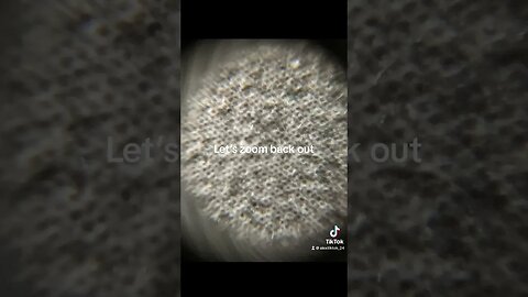 What does a tissue look like under a microscope 🔬