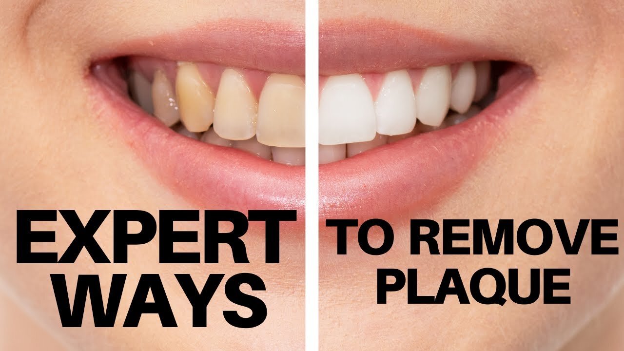 how to remove plaque from teeth | best ways to remove plaque